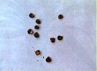 ���F�ڰٺϷN��