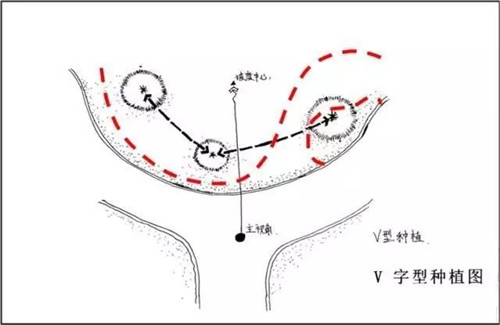 如何讓植物造景在景觀設計中更有范兒？